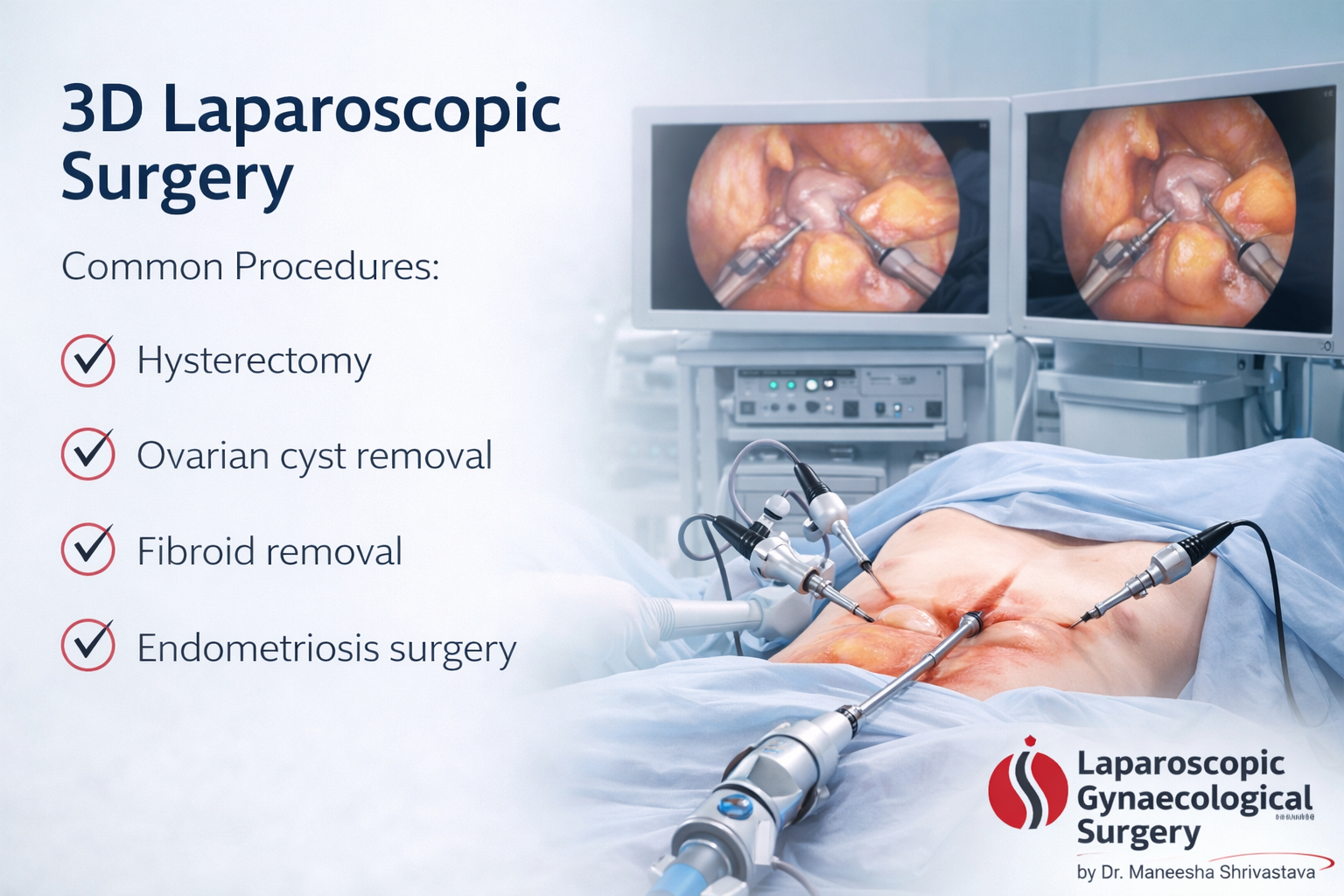 3d laparoscopic surgery hysterectomy fibroid endometriosis treatment