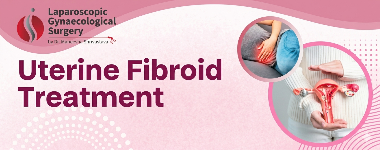 uterine fibroid treatment uterus pain illustration