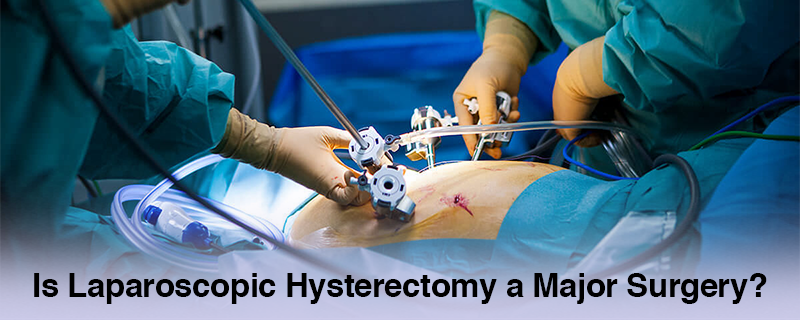 Laparoscopic hysterectomy surgery procedure in operation theatre