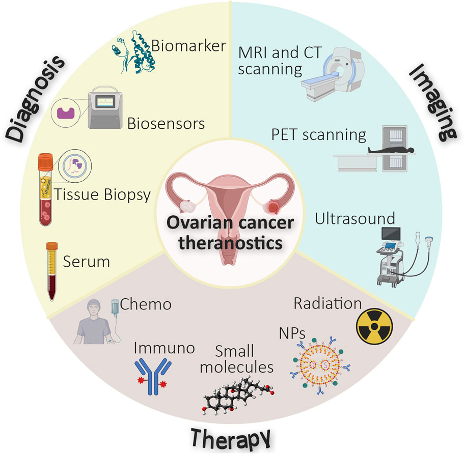 ovarian cancer diagnosis imaging and treatment methods diagram