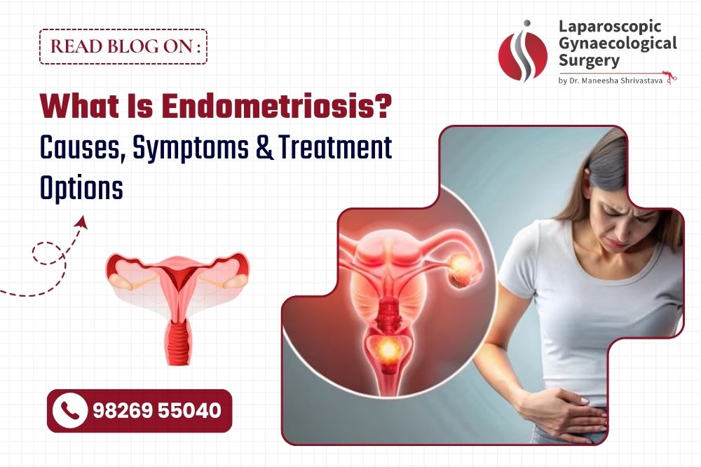 Woman experiencing pelvic pain with illustration of uterus and ovaries representing endometriosis symptoms and treatment options by Dr. Maneesha Shrivastava in Bhopal