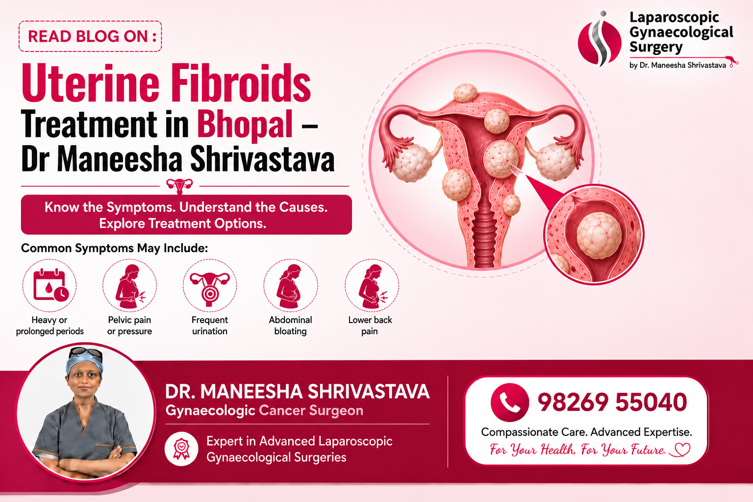 Uterine Fibroids Treatment in Bhopal – Dr Maneesha Shrivastava